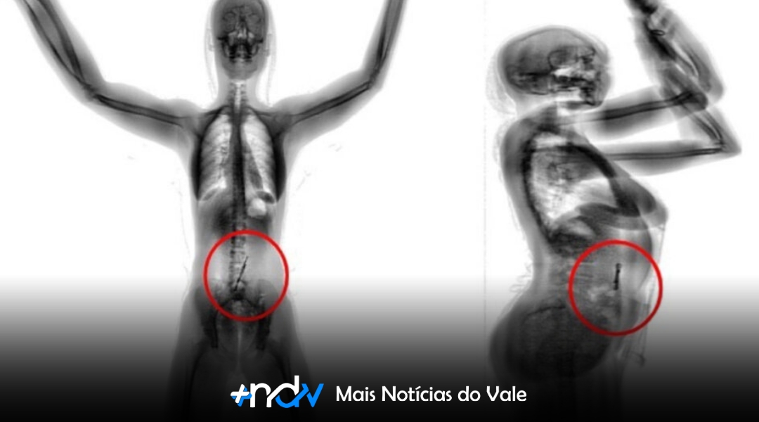 Scanner corporal impede entrada de drogas e arma branca em presídio de Criciúma