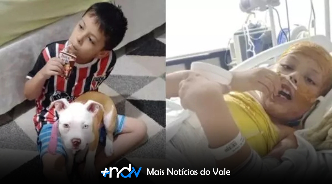 Milagre em Itajaí: Fernando, de 8 anos, sobrevive a choque de 25 mil volts e reaparece sorrindo após meses internado