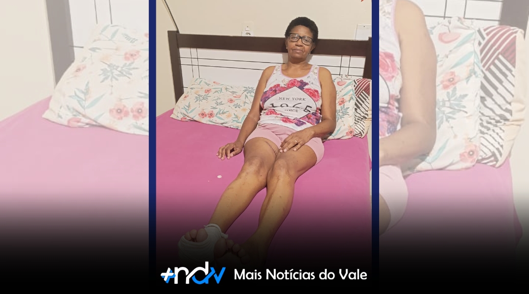 Corrente solidária tenta garantir medicamento de alto custo para paciente com melanoma