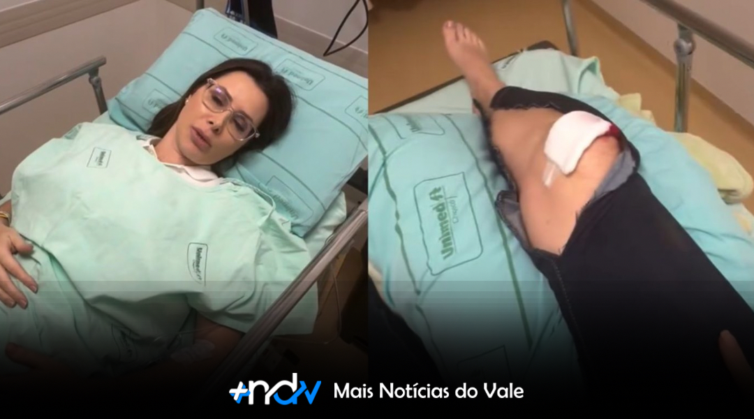 Deputada Carol de Toni passará por cirurgia após ataque de cachorro em SC